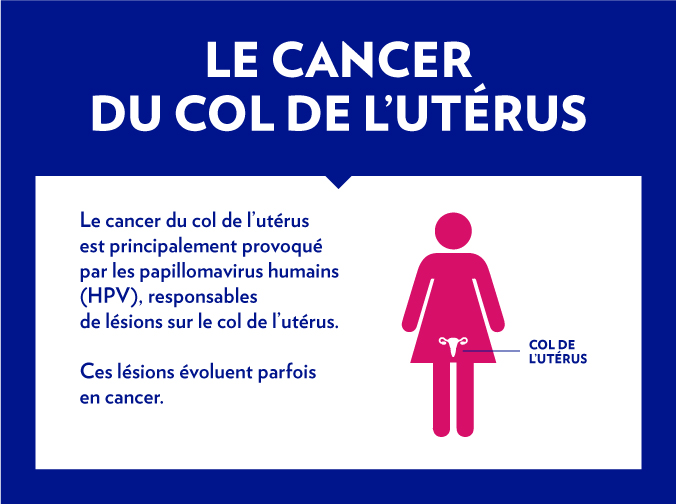 Semaine Européenne de prévention du cancer du col de lutérus CHU Amiens Picardie